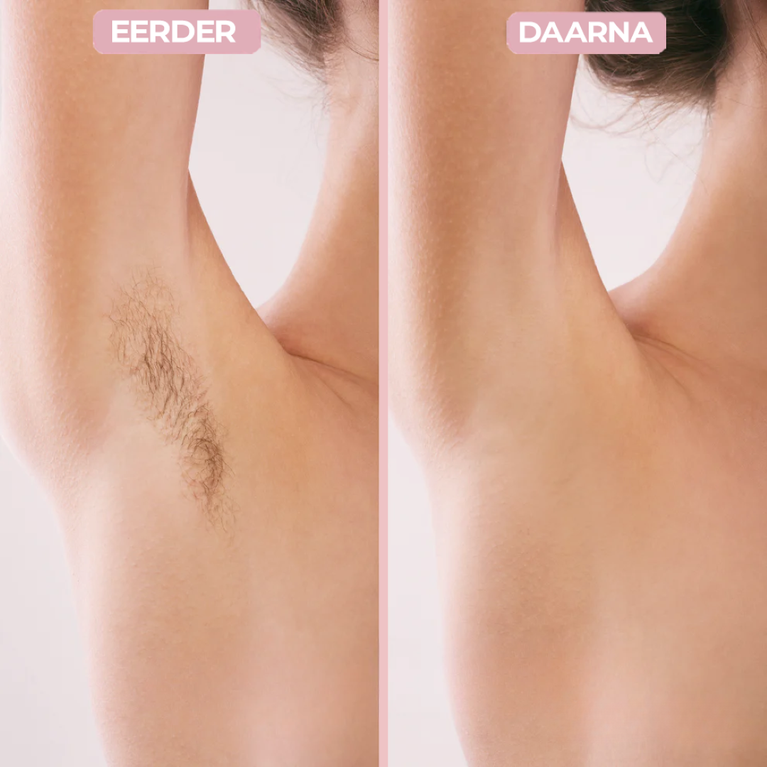 Smoother 2-in-1 Dames Scheerapparaat